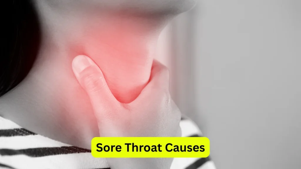Sore Throat Causes