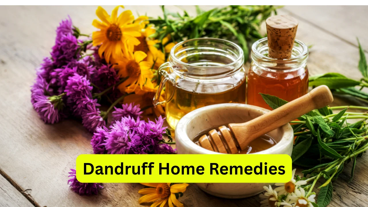 Dandruff Home Remedies